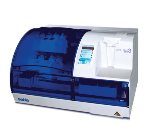 Capillarys 3 OCTA